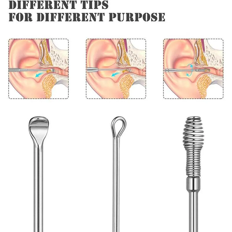 earwax6.webp
